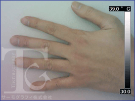 手（人体）の画像02